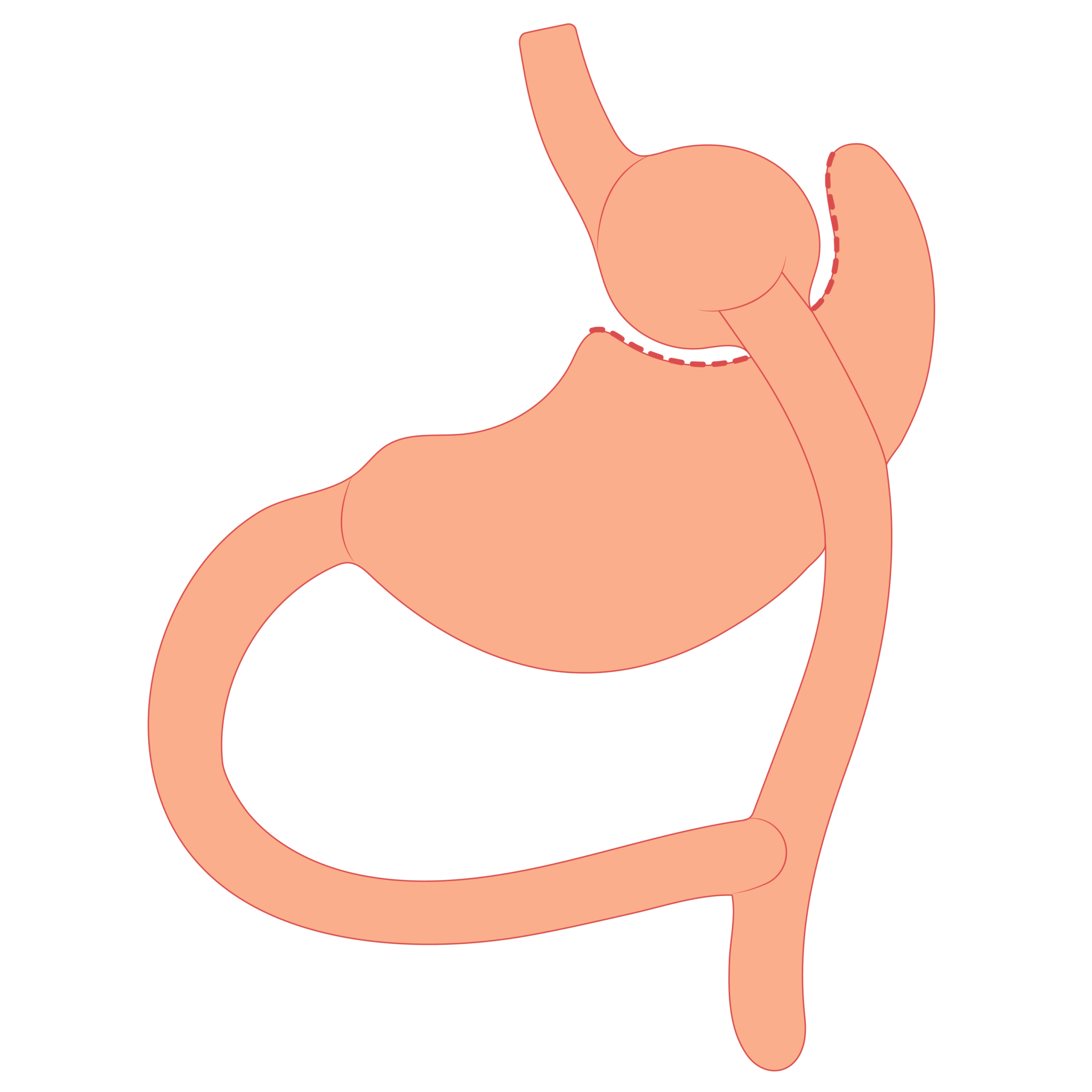 DrCervantesBariatric Bariatric Surgery located in Tijuana Mexico