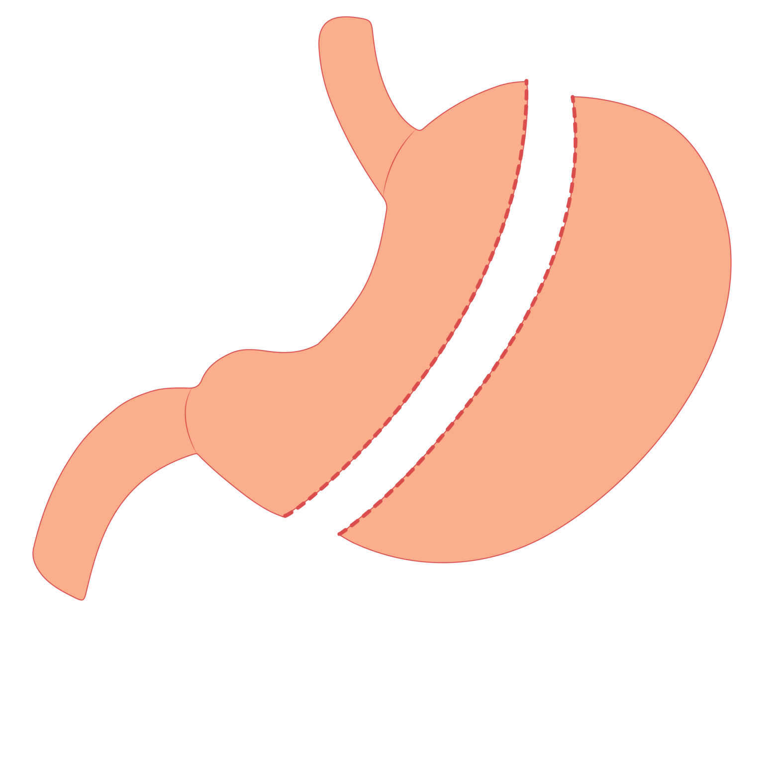 DrCervantesBariatric Bariatric Surgery located in Tijuana Mexico